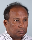 Before Hair Transplant&nbsp;Front